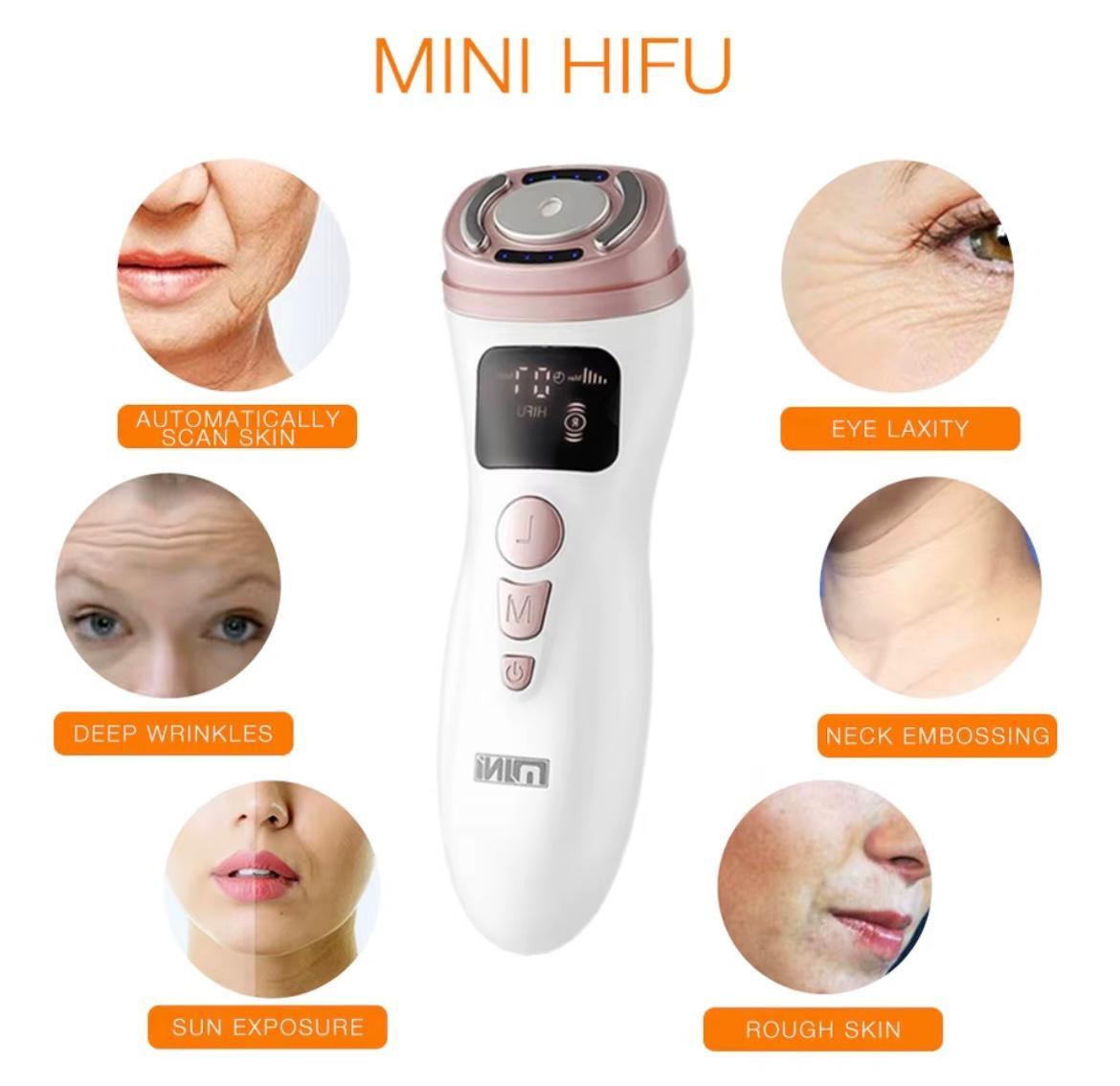 تقنية الترددات الراديوية HIFU 2.0